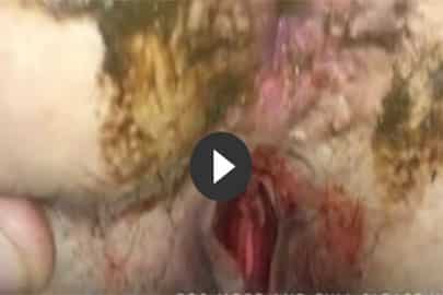 Schmutziger blutiger Fick mit einer geilen Amateur Fotze