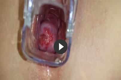 Scheisse in Vagina