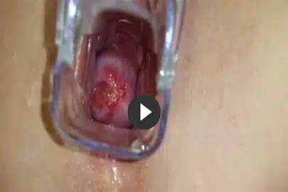 Scheisse in Vagina einer geilen KV Fetisch Schlampe